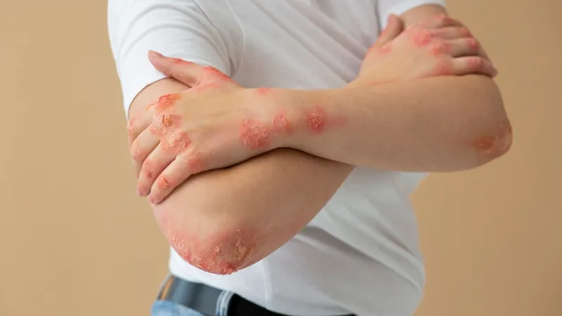 Common Skin Diseases: Types, Symptoms, Causes & Treatment Guide